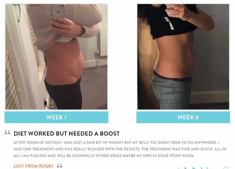 Before and After Dieting Camberley