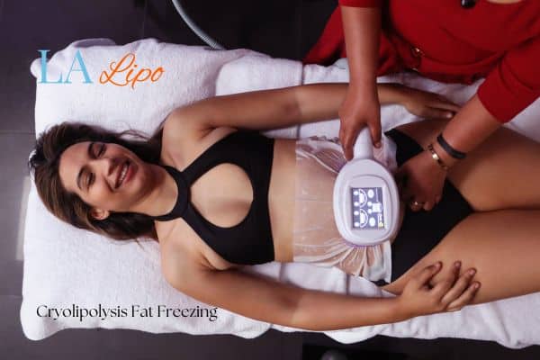 woman getting cryolipolysis Camberley