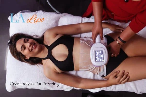 woman getting cryolipolysis Camberley