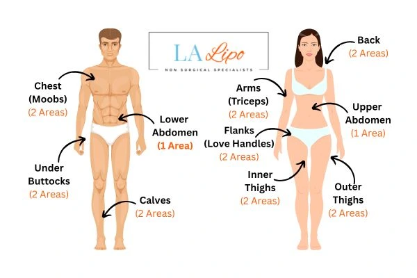 LA LIPO Cryolipolysis Areas Camberley