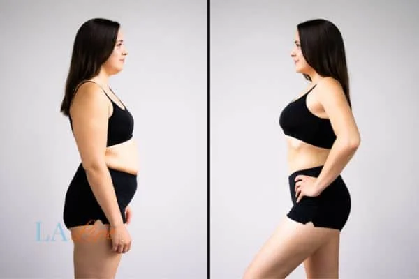 link between body image and mental health Camberley