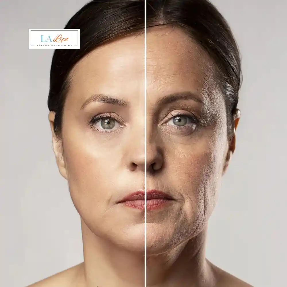 How Can You Tell If Non-Surgical Skin Tightening Is Right for You Camberley?