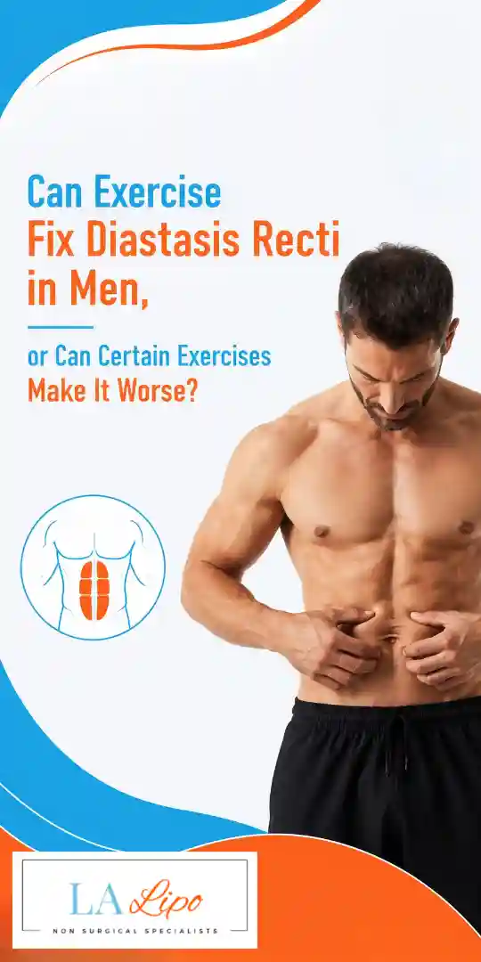 Can Exercise Fix Diastasis Recti in Men, or Can Certain Exercises Make It Worse Camberley?