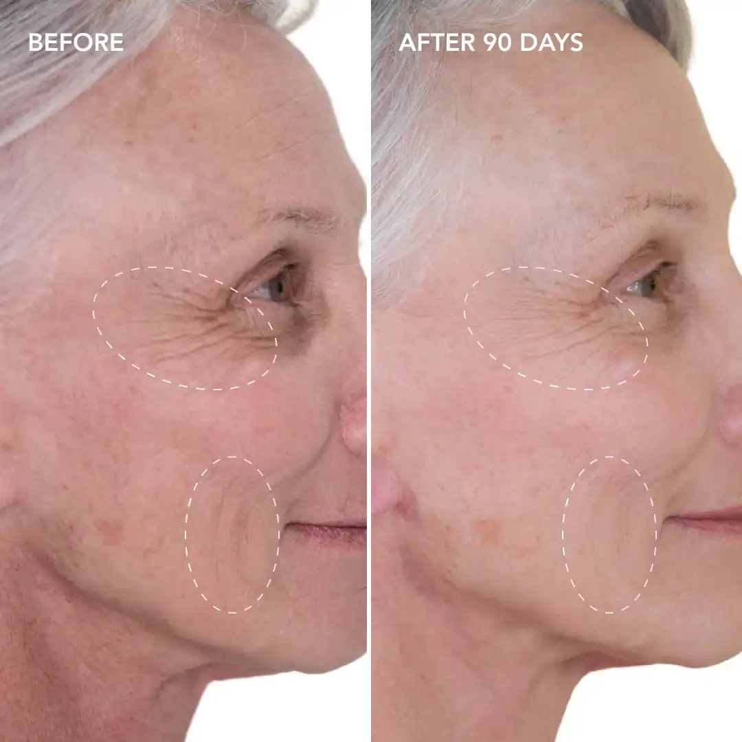 When will you see results Camberley